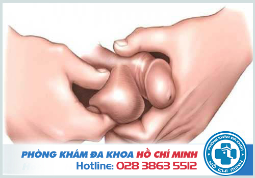 Bệnh sa tinh hoàn là gì? Triệu chứng và cách điều trị