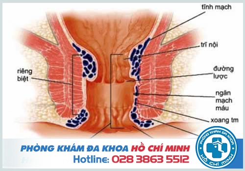 Bệnh viện chữa bệnh trĩ ở Cần Thơ uy tín