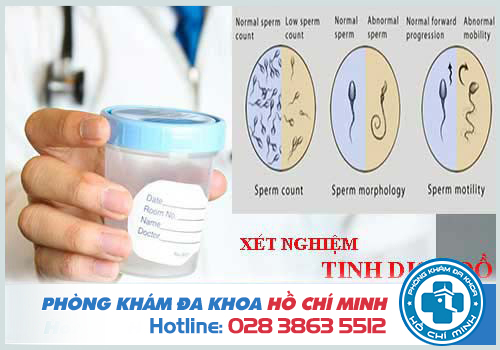 Chi phí xét nghiệm tinh dịch đồ hết bao nhiêu tiền 2019