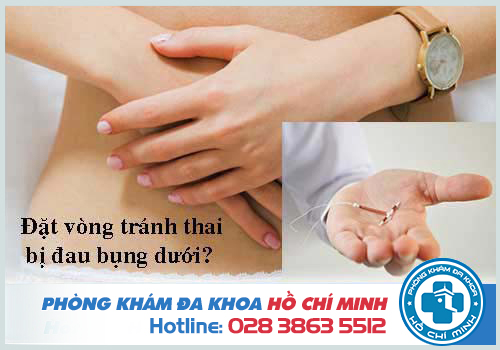 Đặt vòng tránh thai bị đau bụng dưới và đau lưng