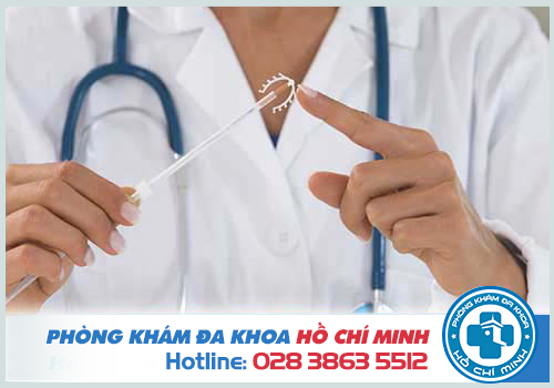 Nên cân nhắc đặt vòng tránh thai trong trường hợp nào