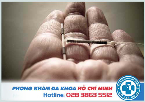 Đặt vòng tránh thai quan hệ ra máu có sao không