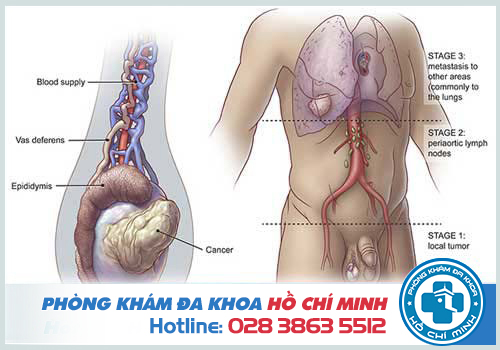 Đau tinh hoàn thì uống thuốc gì và mua ở đâu