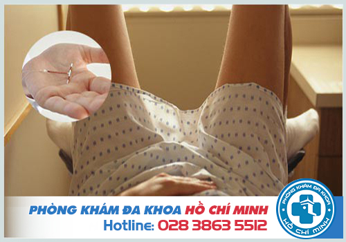 Địa chỉ tháo vòng tránh thai an toàn nhanh chóng tại TPHCM