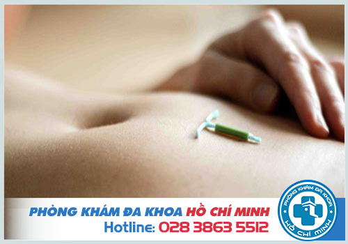 Địa chỉ tháo vòng tránh thai tốt nhất phải đảm bảo vô trùng