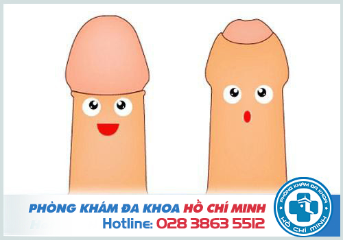 hình ảnh bao quy đầu
