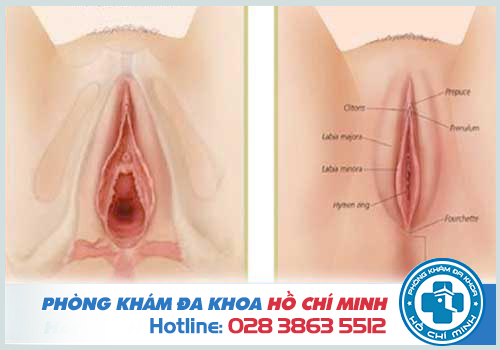 Sau phẫu thuật thu hẹp vùng kín khăng khí, không sẹo