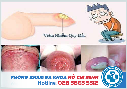 Phòng khám nam khoa quận 10