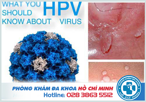 HPV mẫu vi rút dẫn tới bệnh mồng gà