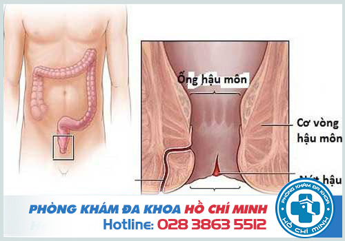 Nguyên nhân gây ra rò hậu môn