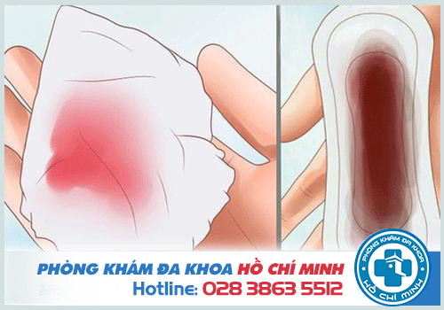 Bệnh rong kinh có nguy hiểm không? Cách chữa trị hiệu quả