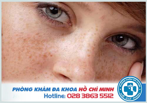 Tắc kinh là gì