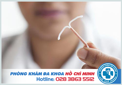 Tháo vòng tránh thai có thể bị chậm kinh hoặc rong kinh