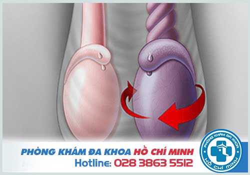 Tinh hoàn 1 bên to 1 bên nhỏ có sao không? Địa chỉ chữa bệnh