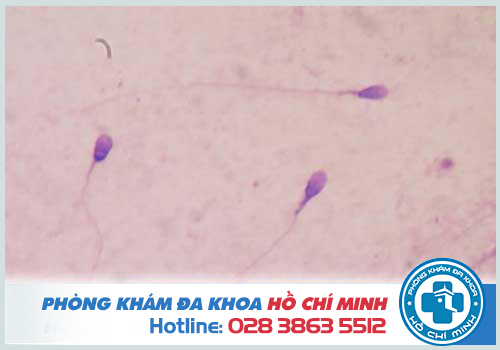 Tinh trùng loãng khi số lượng chỉ 15 triệu con/ml