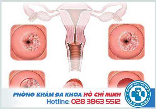 Giải đáp thắc mắc các bệnh phụ khoa thường gặp