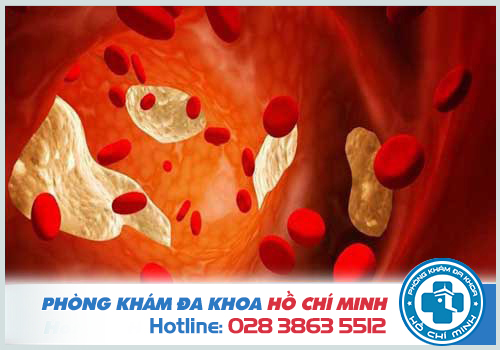 Ứ dịch tử cung sau hút thai có nguy hiểm không