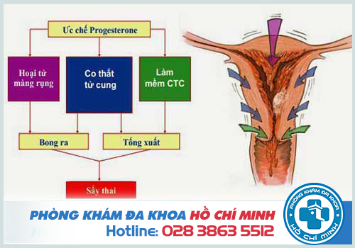 Cơ chế của phá thai bằng thuốc