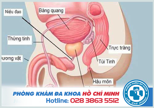 Viêm tuyến tiền liệt có chữa được không?