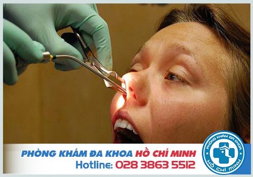 Viêm xoang mũi chảy máu nguy hiểm khi không điều trị đúng cách