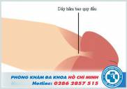 Đứt dây hãm bao quy đầu có sao không và cách chữa trị