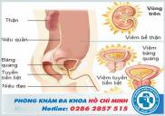 Khám chữa bệnh viêm đường tiết niệu ở đâu tốt TPHCM 2019