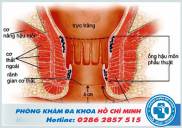 Khám hậu môn trực tràng ở đâu tốt nhất TPHCM năm 2019