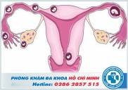 Địa chỉ chữa viêm vùng chậu ở đâu tốt nhất tại TPHCM 2019